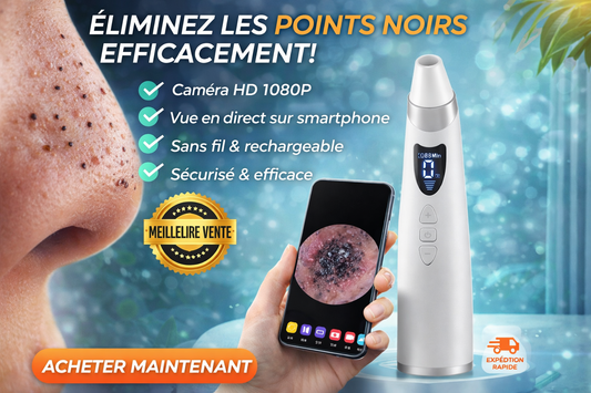 La solution n°1 contre les points noirs – Résultats visibles chez vous